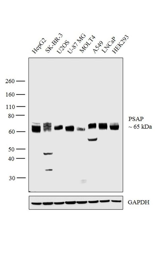 PSAP Antibody in Western Blot (WB)