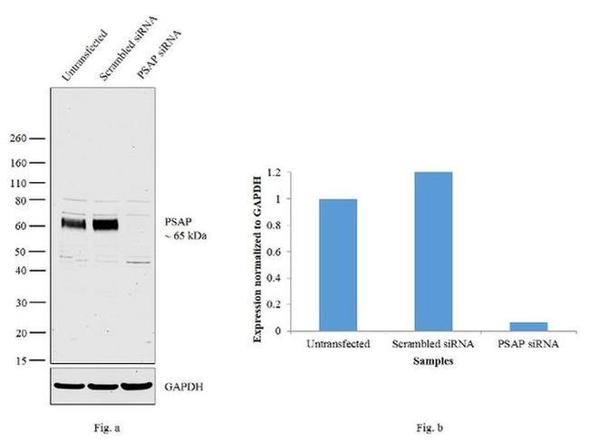 PSAP Antibody in Western Blot (WB)