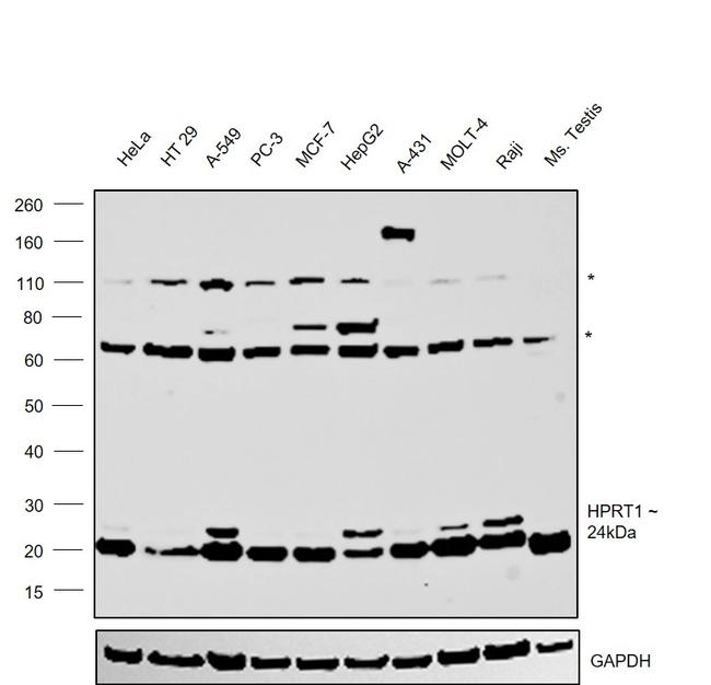 HPRT1 Antibody in Western Blot (WB)