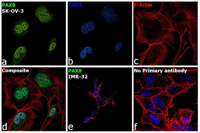 PAX8 Antibody in Immunocytochemistry (ICC/IF)