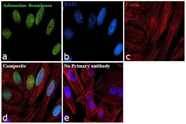 ADAR1 Antibody in Immunocytochemistry (ICC/IF)