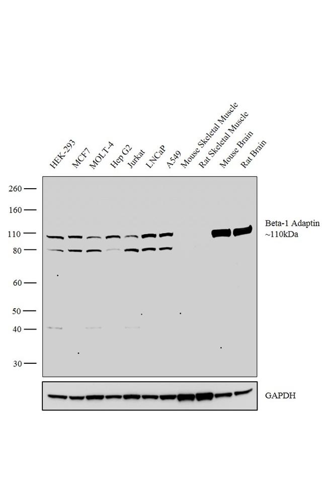 beta-1 Adaptin Antibody in Western Blot (WB)