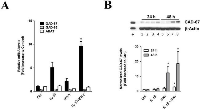 GAD67 Antibody in Western Blot (WB)