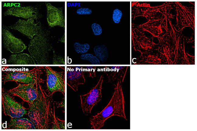 ARPC2 Antibody in Immunocytochemistry (ICC/IF)