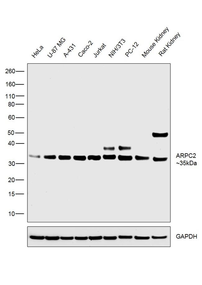 ARPC2 Antibody in Western Blot (WB)