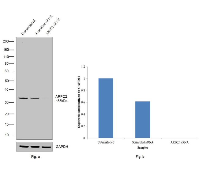 ARPC2 Antibody in Western Blot (WB)