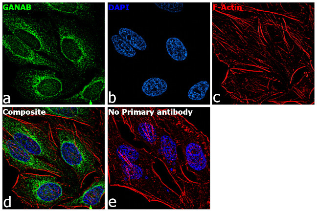 GANAB Antibody in Immunocytochemistry (ICC/IF)