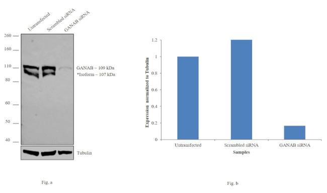 GANAB Antibody in Western Blot (WB)