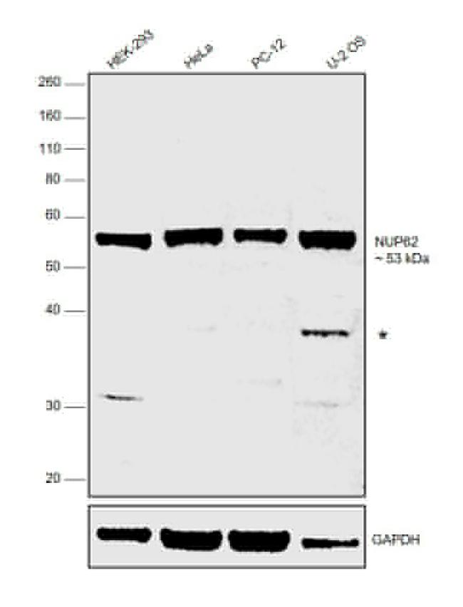 NUP62 Antibody in Western Blot (WB)