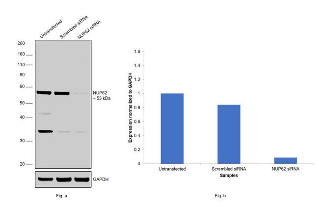 NUP62 Antibody in Western Blot (WB)