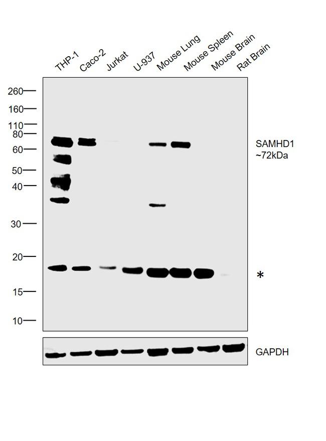 SAMHD1 Antibody in Western Blot (WB)