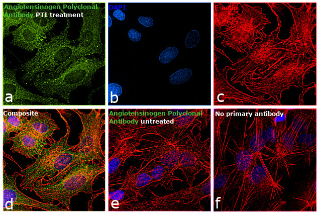 Angiotensinogen Antibody in Immunocytochemistry (ICC/IF)