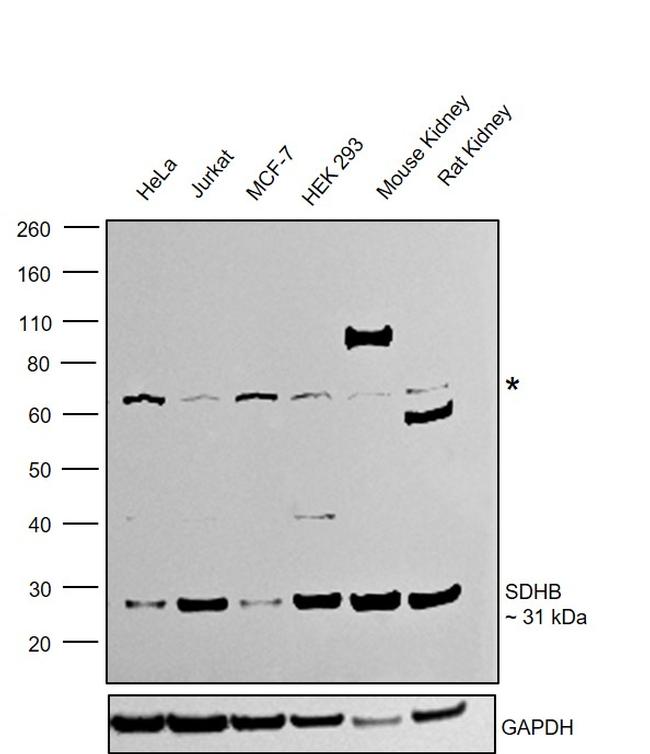 SDHB Antibody in Western Blot (WB)