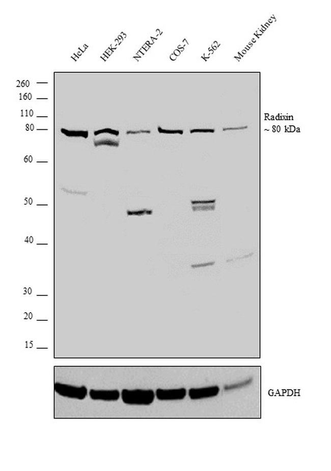 Radixin Antibody in Western Blot (WB)