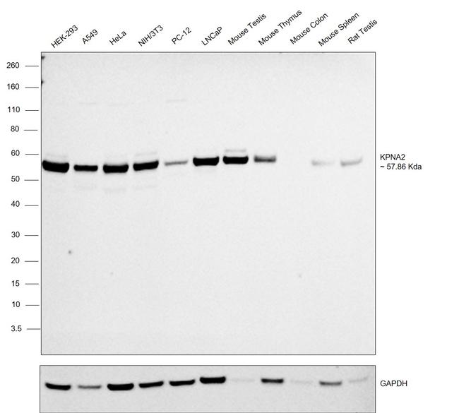 KPNA2 Antibody in Western Blot (WB)