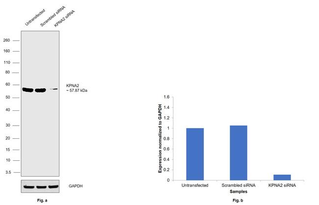 KPNA2 Antibody in Western Blot (WB)