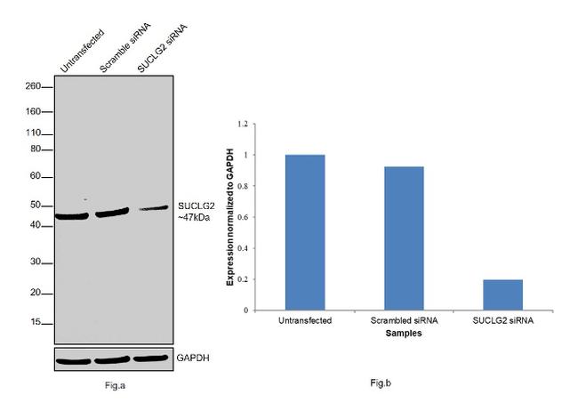 SUCLG2 Antibody in Western Blot (WB)