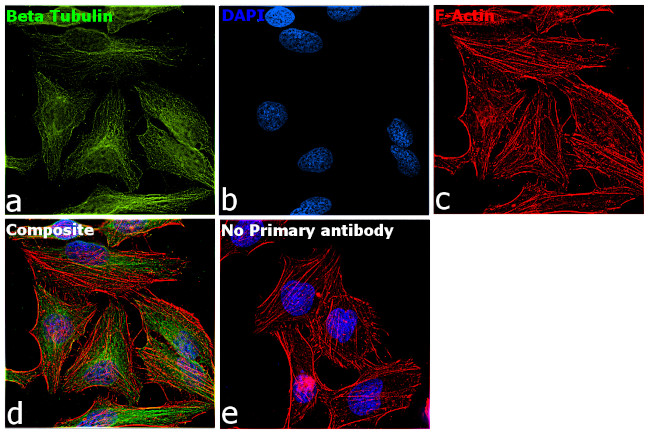 beta Tubulin Antibody in Immunocytochemistry (ICC/IF)