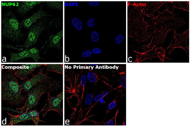 NUP62 Antibody in Immunocytochemistry (ICC/IF)