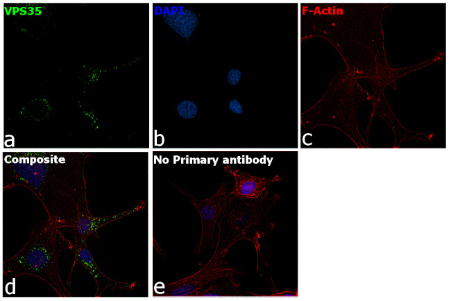 VPS35 Antibody in Immunocytochemistry (ICC/IF)