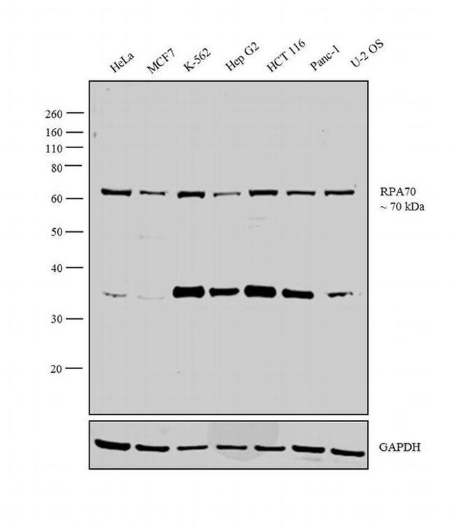 RPA70 Antibody in Western Blot (WB)