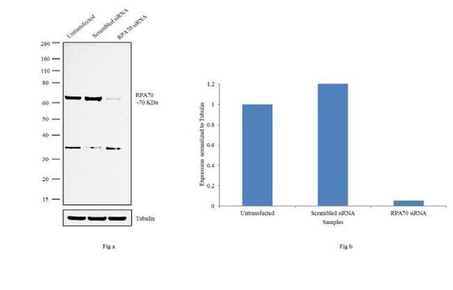 RPA70 Antibody in Western Blot (WB)