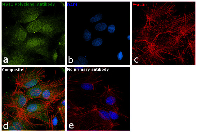 MST1 (STK4) Antibody in Immunocytochemistry (ICC/IF)