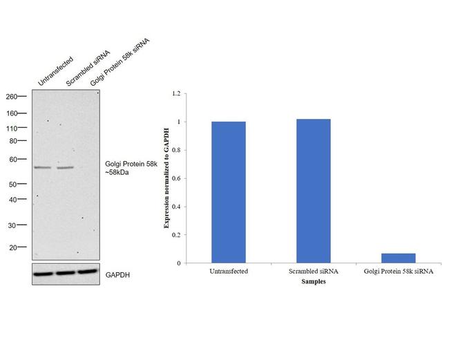 Golgi protein 58k Antibody in Western Blot (WB)