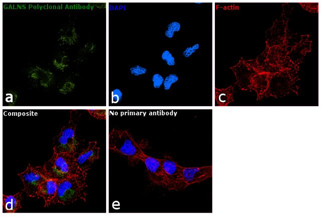 GALNS Antibody in Immunocytochemistry (ICC/IF)