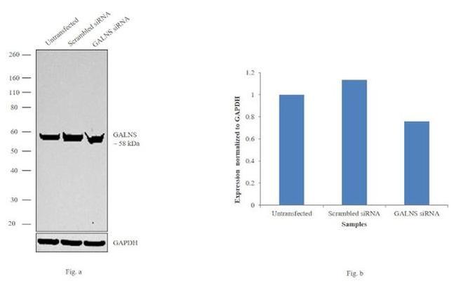 GALNS Antibody in Western Blot (WB)