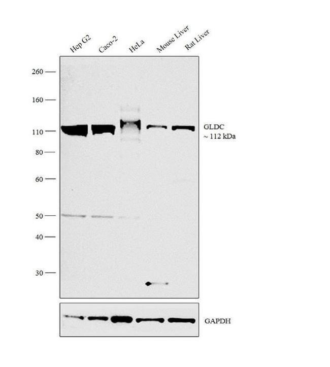 GLDC Antibody in Western Blot (WB)