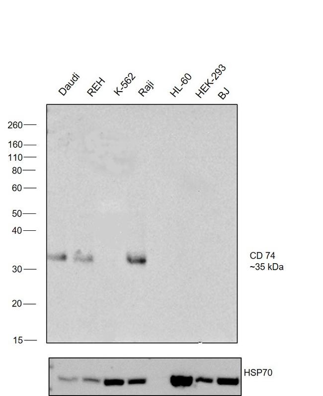 CD74 Antibody in Western Blot (WB)