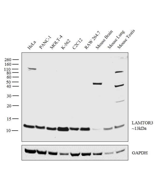 LAMTOR3 Antibody in Western Blot (WB)