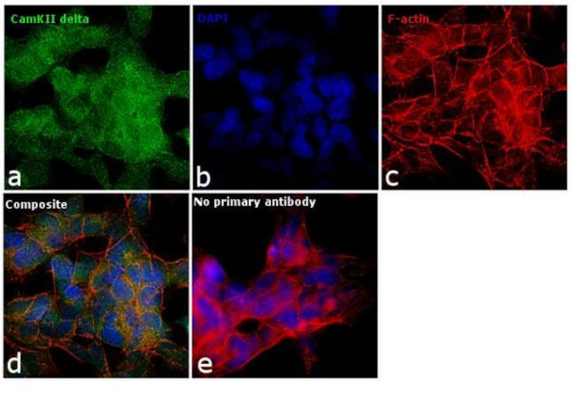 CaMKII delta Antibody in Immunocytochemistry (ICC/IF)