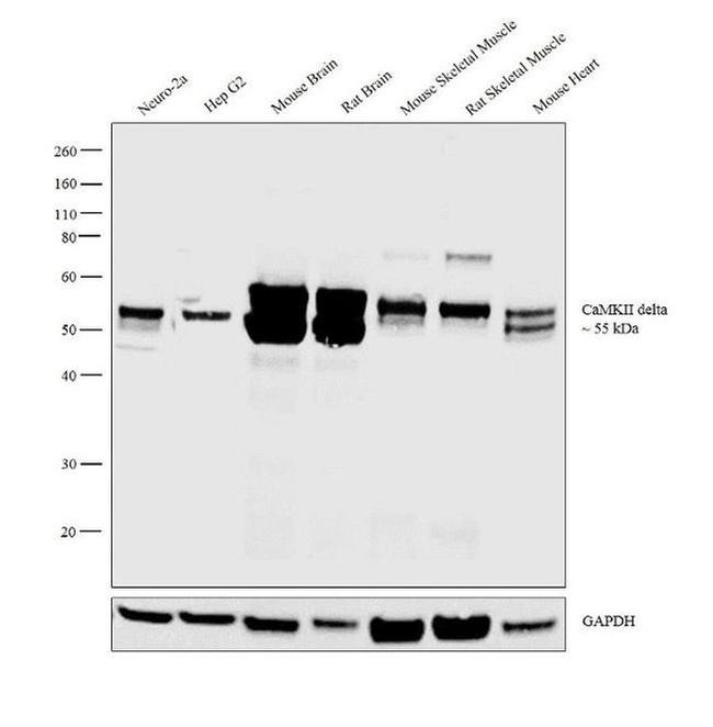 CaMKII delta Antibody in Western Blot (WB)