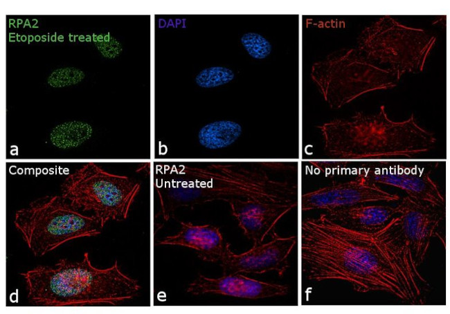 RPA2 Antibody in Immunocytochemistry (ICC/IF)