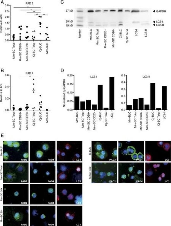 PADI4 Antibody in Immunocytochemistry (ICC/IF)