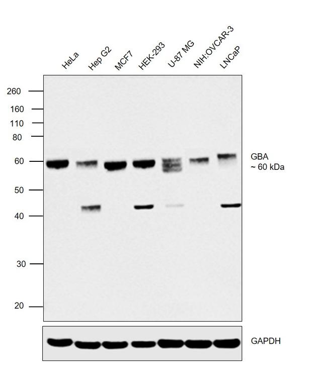 GBA Antibody in Western Blot (WB)