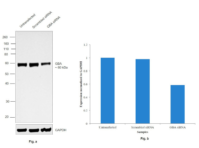 GBA Antibody