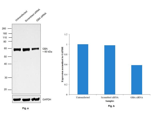 GBA Antibody in Western Blot (WB)