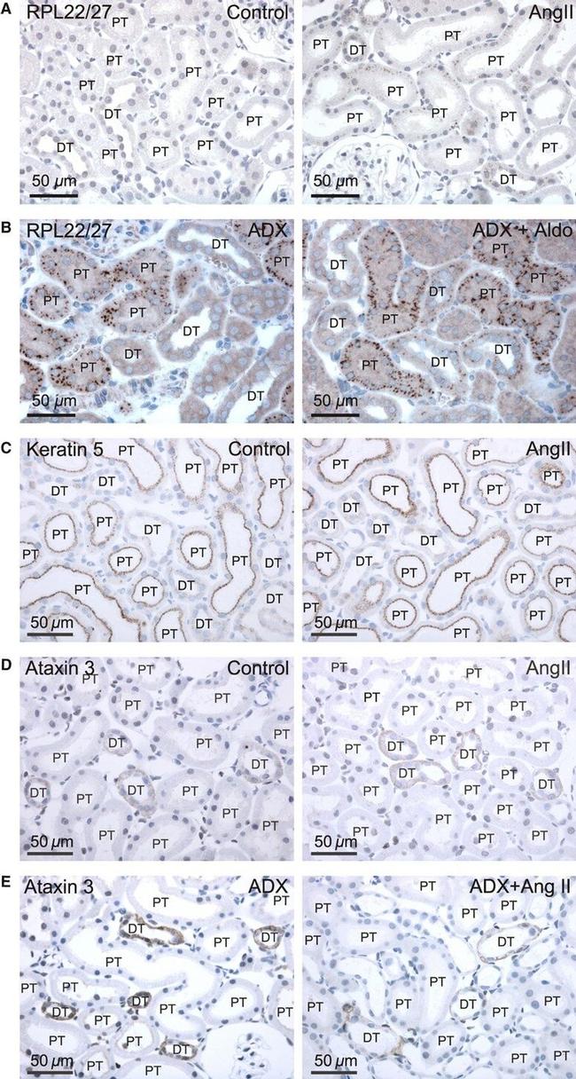 Ataxin 3 Antibody in Immunohistochemistry (IHC)