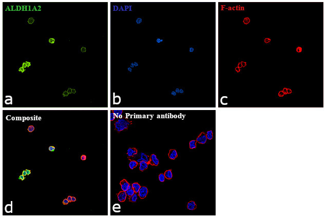 ALDH1A2 Antibody in Immunocytochemistry (ICC/IF)