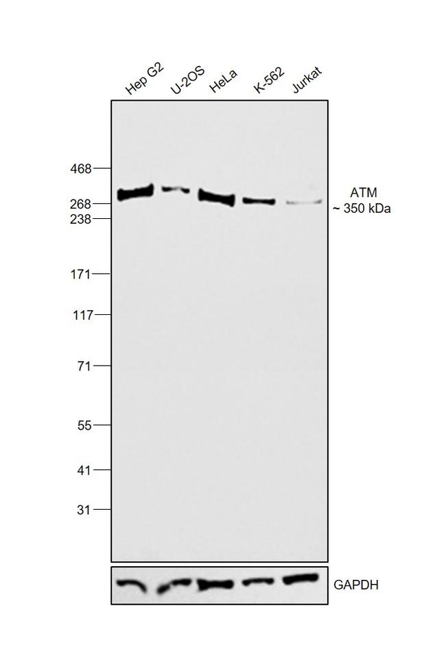 ATM Antibody in Western Blot (WB)