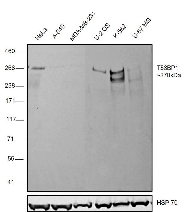 53BP1 Antibody in Western Blot (WB)