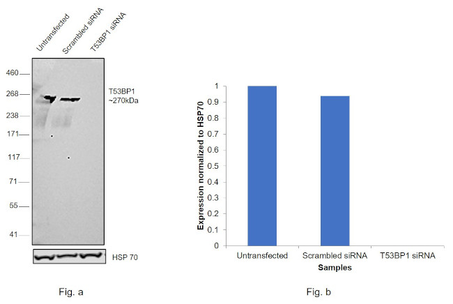 53BP1 Antibody