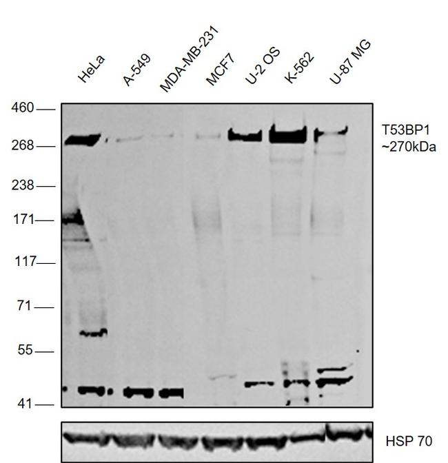 53BP1 Antibody in Western Blot (WB)