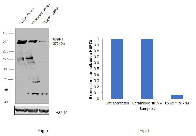 53BP1 Antibody