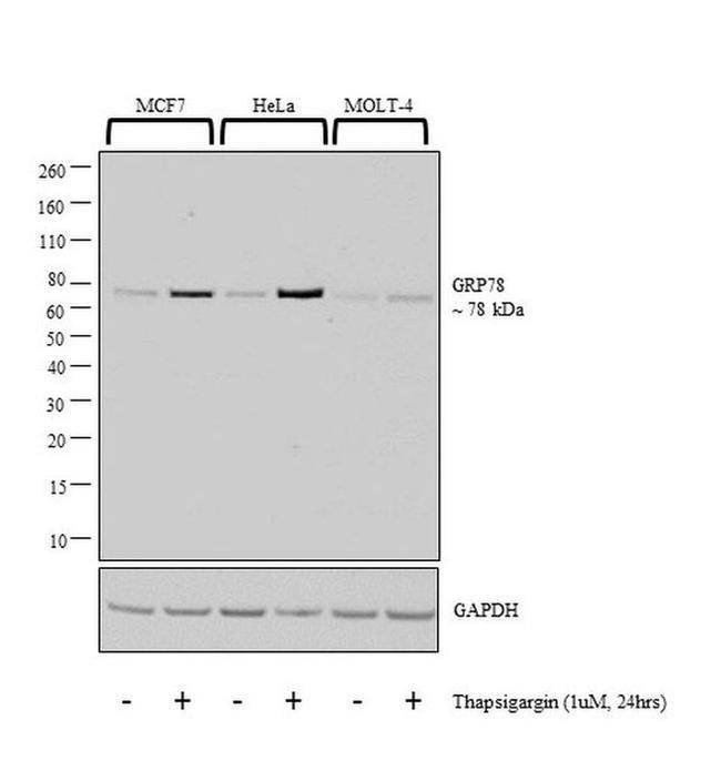 GRP78 Antibody in Western Blot (WB)