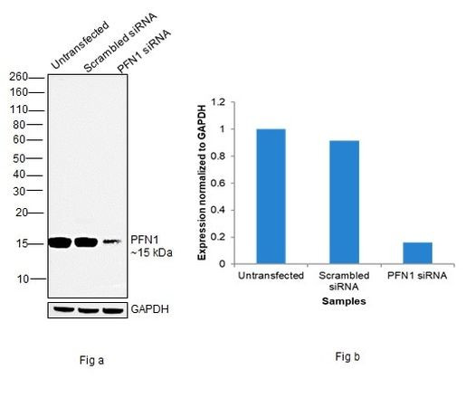 Profilin 1 Antibody