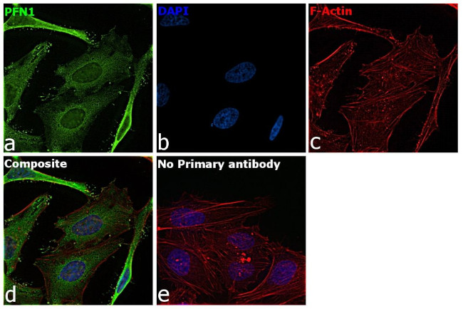 Profilin 1 Antibody in Immunocytochemistry (ICC/IF)